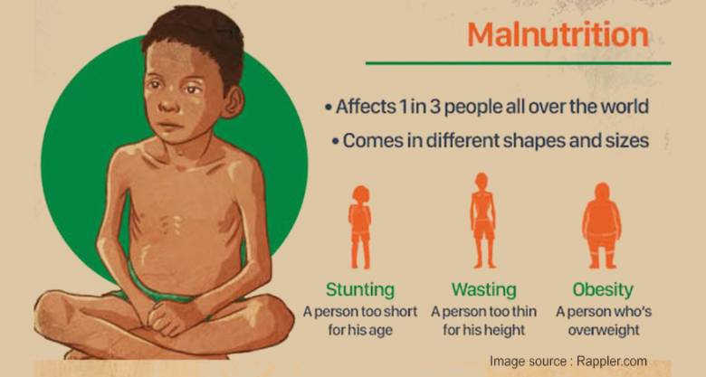 Malanutrisi